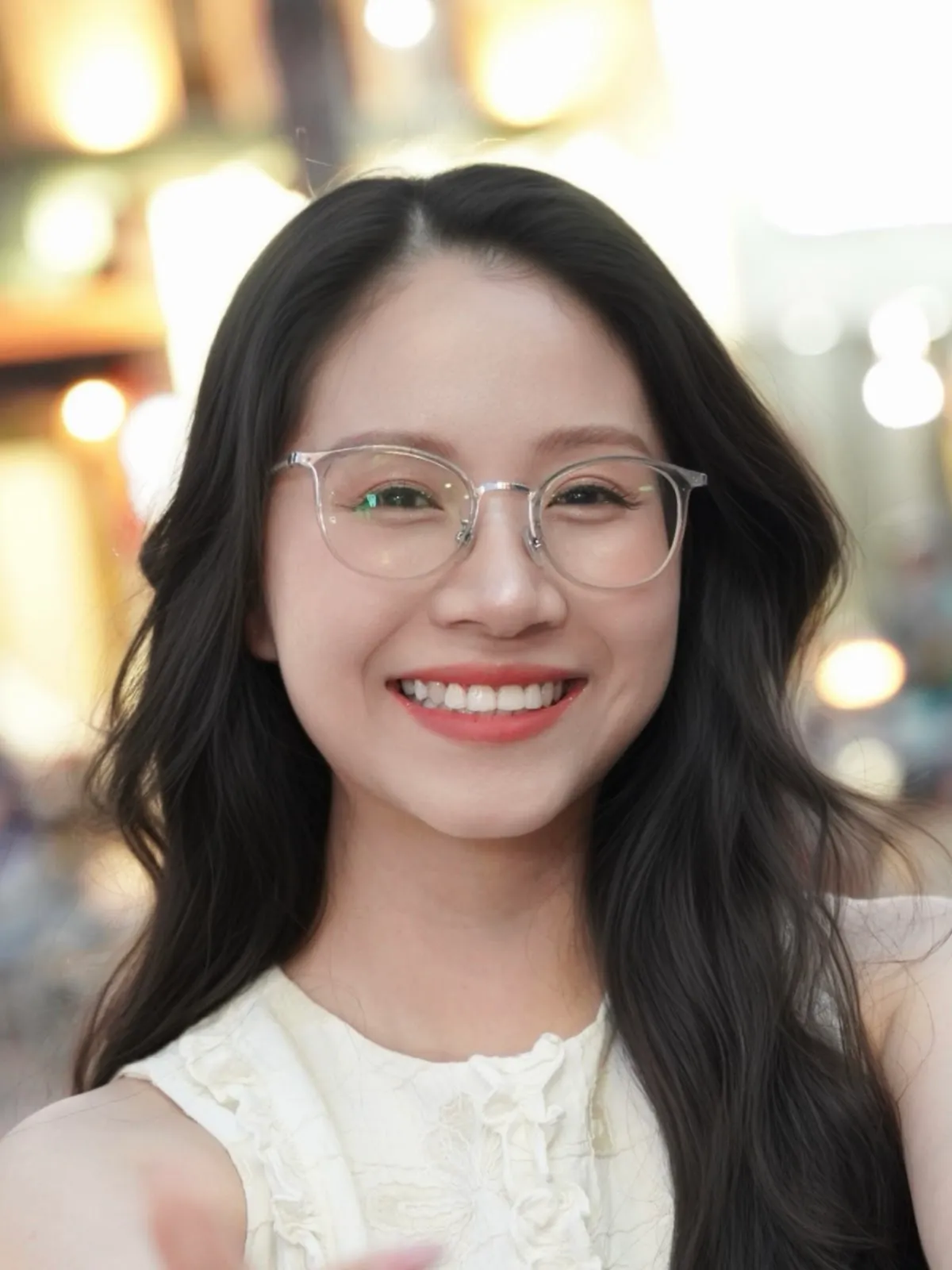 Kết quả niềng răng của Thanh Trâm