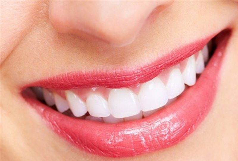 Một số lợi ích khi niềng răng