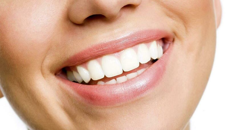 Có nên tẩy trắng răng không? Có gây hại cho răng không?