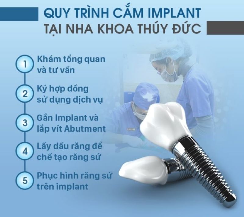 Quy trình trồng răng implant tại nha khoa uy tín