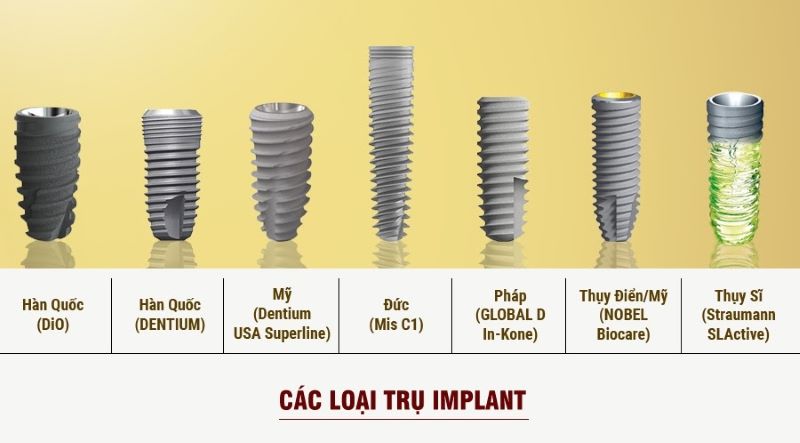Chất lượng của trụ Implant