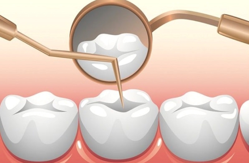 Viêm tủy răng là gì?