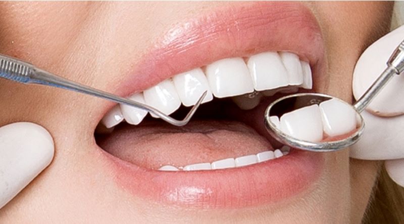 Cách chăm sóc, vệ sinh răng miệng sau khi bọc răng sứ