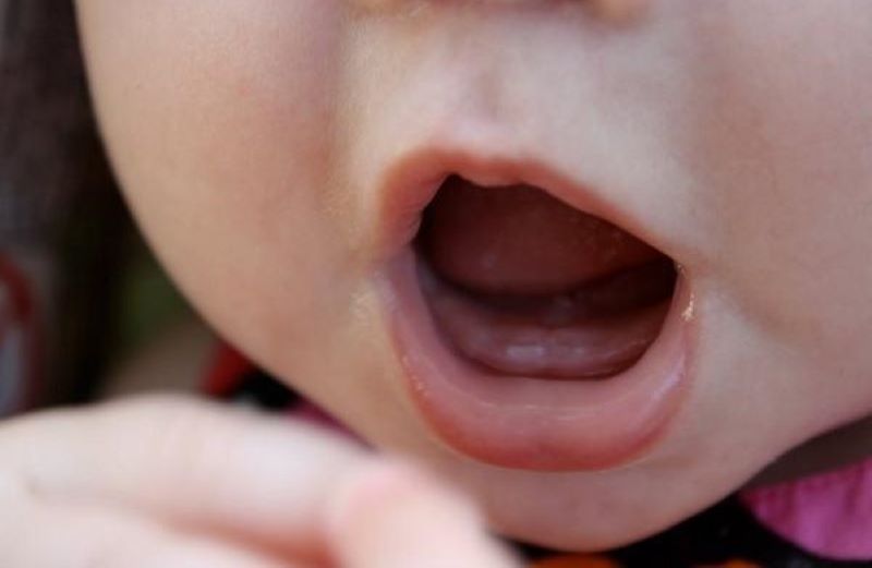 Những lưu ý giúp trẻ giảm đau trong quá trình mọc răng