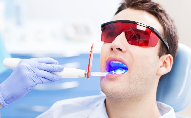 Tẩy trắng răng tại phòng khám