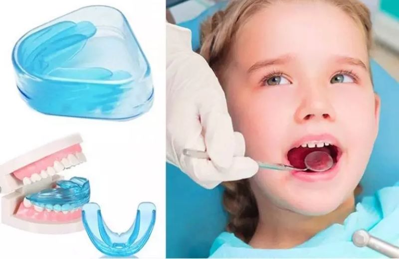 Niềng răng cho trẻ em bằng phương pháp niềng răng tháo lắp