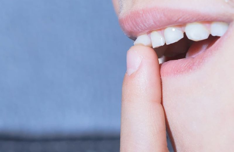 Các biện pháp khắc phục hiện tượng răng lung lay