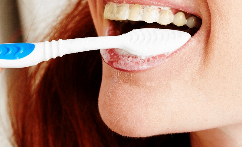 Nguyên nhân tại sao đánh răng thường xuyên mà răng vẫn vàng
