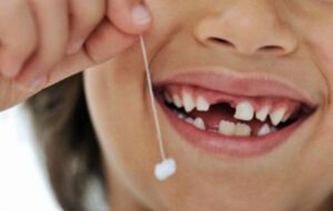1 số cách nhổ răng tại nhà theo dân gian
