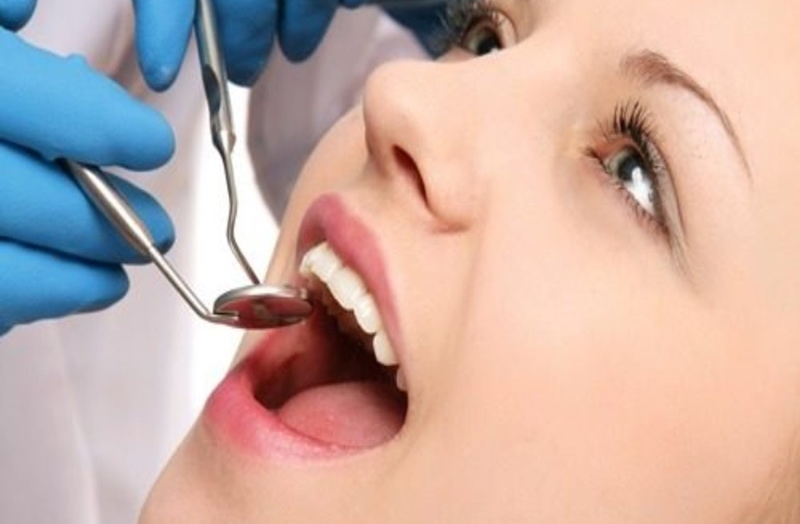 Cách điều trị cao răng đen