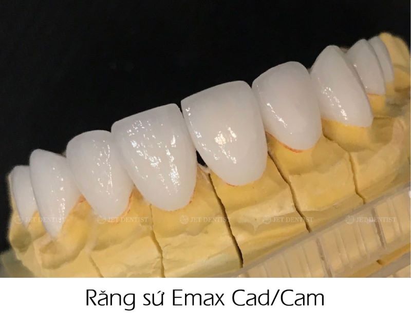 răng sứ Emax CAD